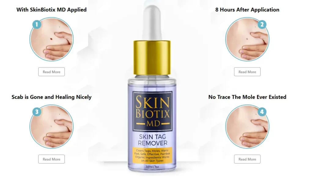 Defy Skin Tag Remover™ » (Official) - Effortlessly Remove Skin Tags